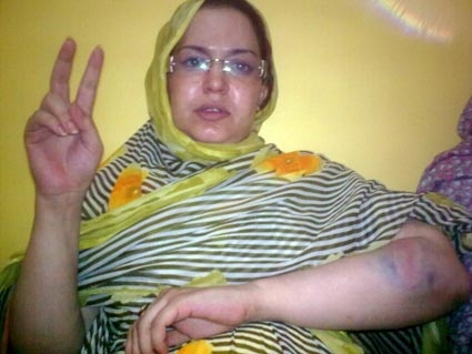 تعرض ناشطة حقوقية صحراوية للمضايقة والتعنيف بمدينة بوجدور المحتلة
